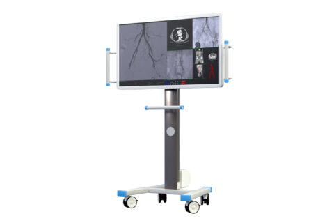 Monitor supplementari
